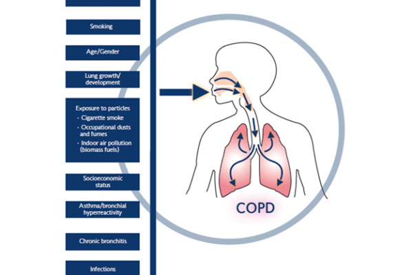 COPD-contributing-factors.ashx_.png
