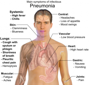 Main_symptoms_of_infectious_pneumonia1-300x288.png