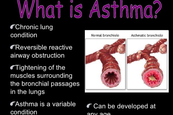 asthma-presentation-3-7281.jpg