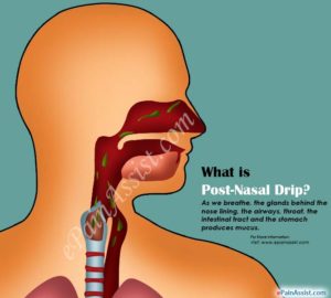 what-post-nasal-drip