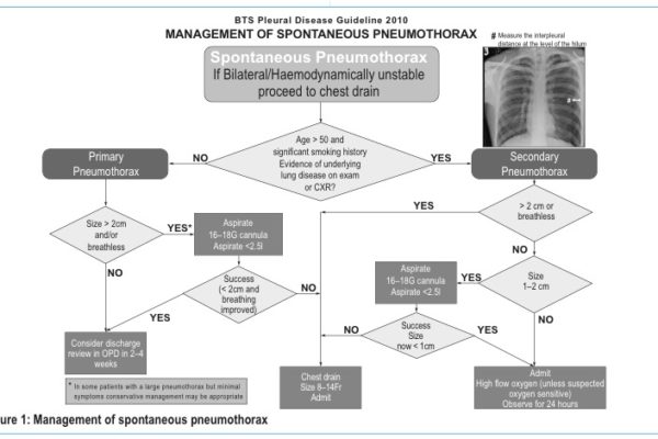 Pneumothorax-flowchart2.jpg